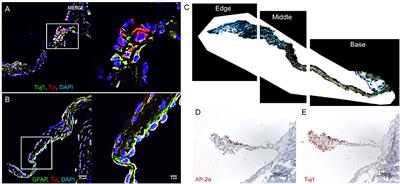 Elastogenesis Correlates With Pigment Production in Murine Aortic Valve Leaflets